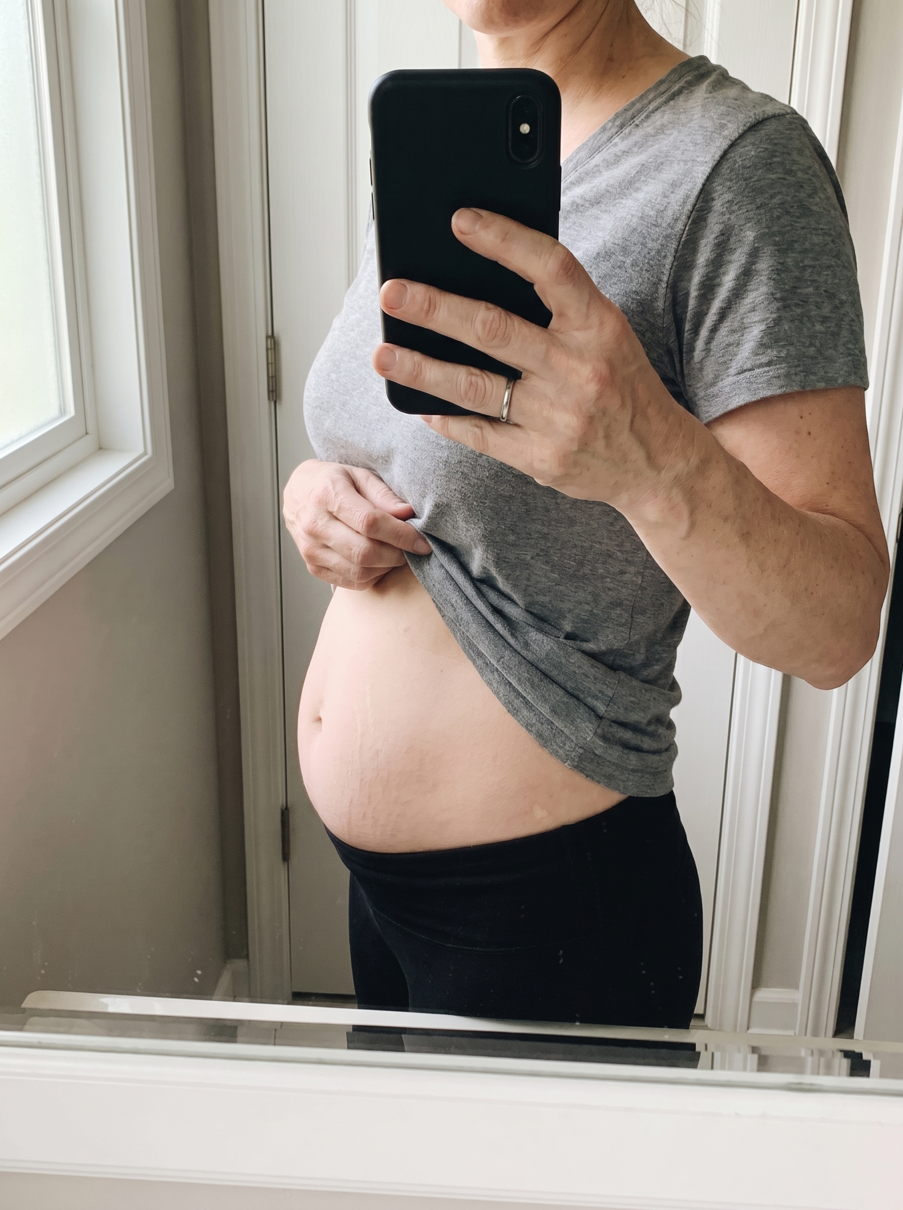 Ventre après la grossesse