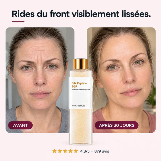Rides du front visiblement lissées : avant / après 30 jours